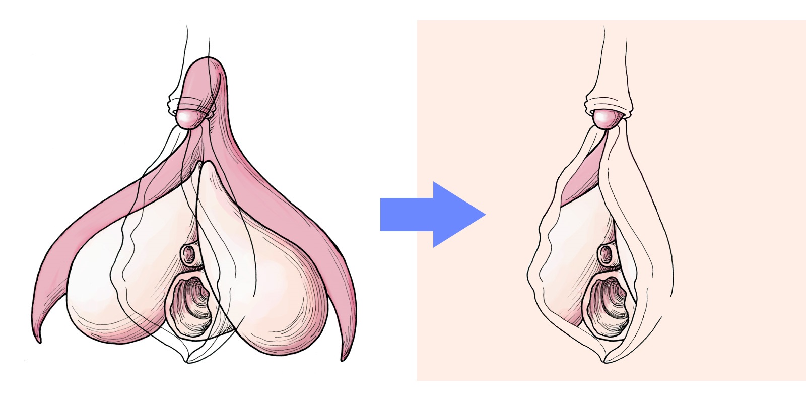 Most of the clitoris is hidden within the body